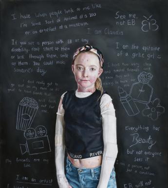 A young girl dressed in blue jeans and a black vest stands in front of a blackboard. She has dressings on her arms and visible under her vest, and we can see a few blisters on her skin. The blackboard behind her is covered in writing, all about the personality of Claudia, the subject of the portrait.